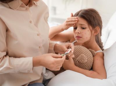 Chickenpox Vaccine: A Vital Step in Protecting Your Child 